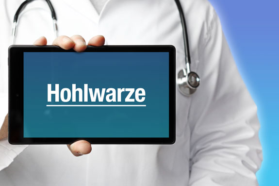 Schlupfwarzen Hildesheim